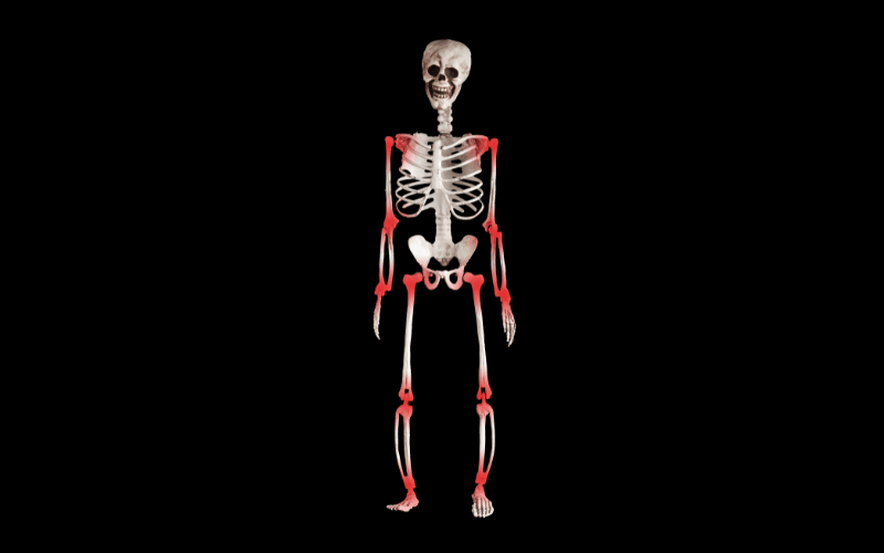 Aching Joints Pemphigus's Reach Beyond the Skin