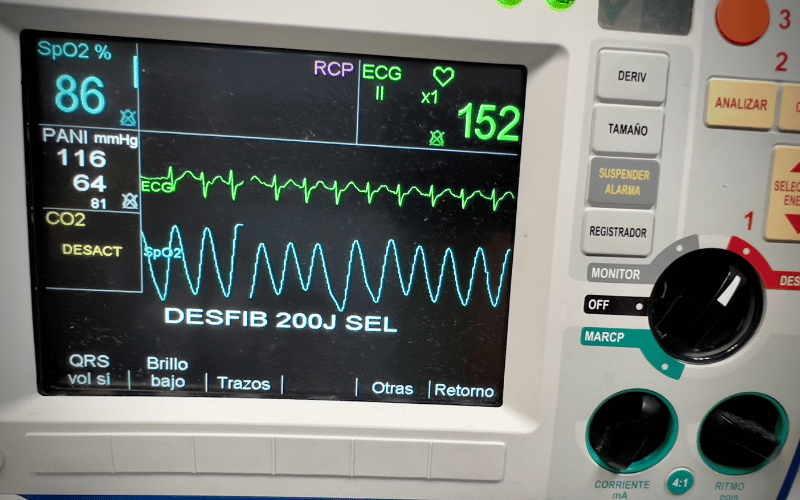 Rapid Heart Rate The Heart's Frantic Beat