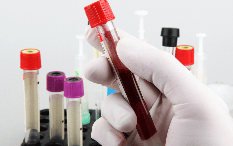 Abnormal Blood Tests - Reading Between the Lines