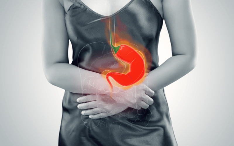 Acid Reflux and Heartburn