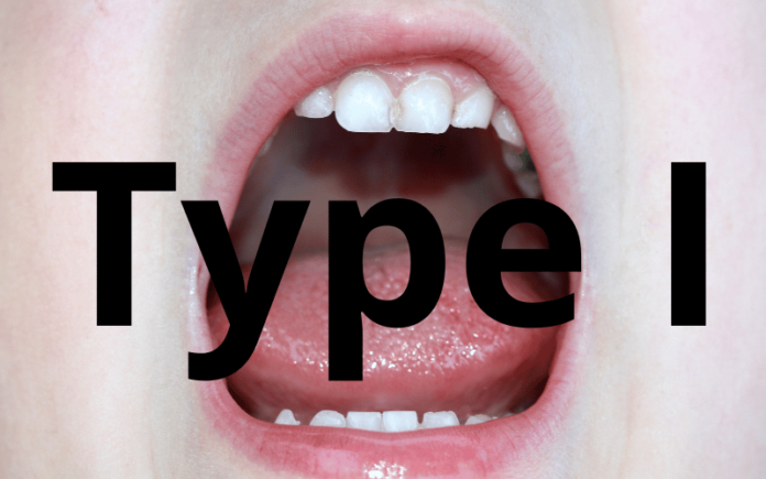 Demystifying Ankyloglossia: A Deep Dive into the Four Types of Tongue Tie