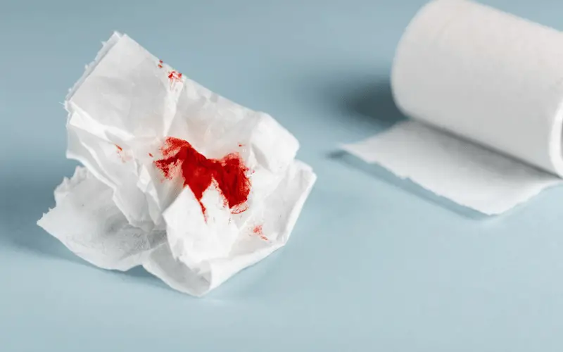 Bloody Diarrhea 10 Critical Facts Everyone Should Know