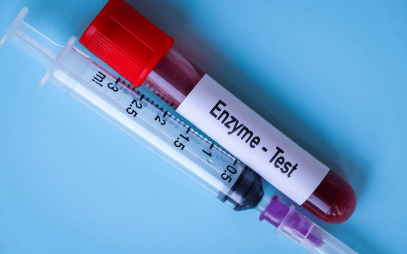 Change in Pancreatic Enzymes A Hidden Culprit
