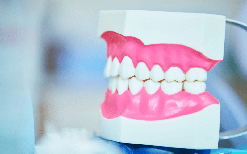 Changes in How Your Teeth Fit Together – A Mysterious Maladjustment