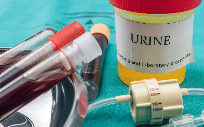 Changes in Urine