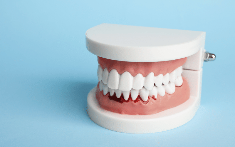 Changes in the Way Your Teeth Fit Together – A Subtle Shift in Alignment