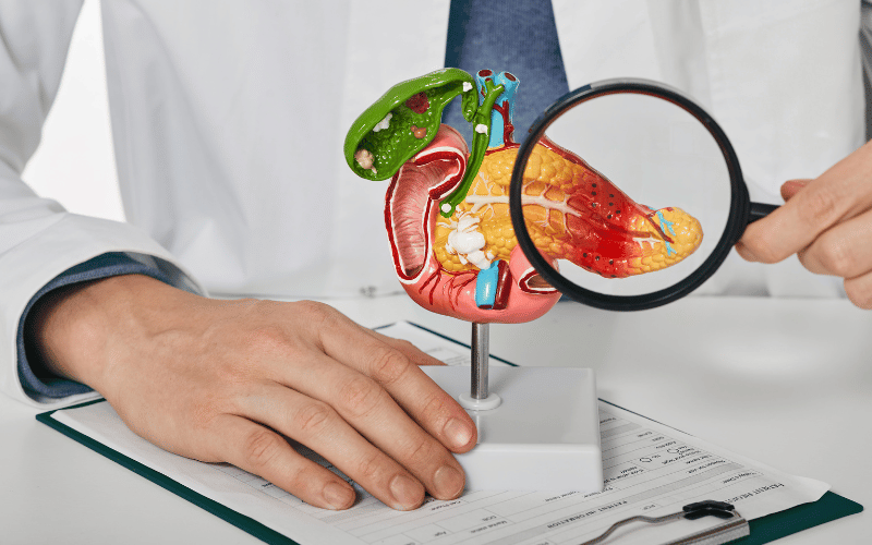 Chronic Pancreatitis An Overview