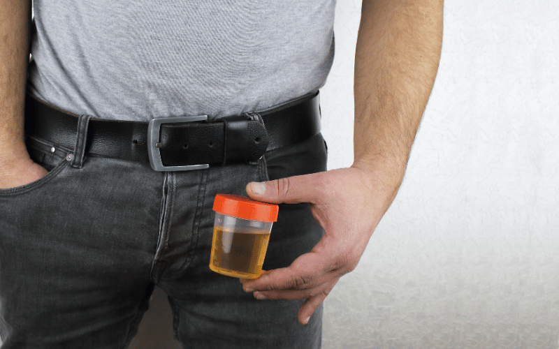 Dark Urine A Telling Sign of Liver Issues