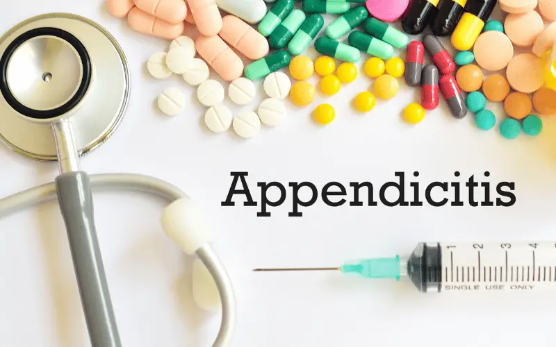 Decoding Appendicitis Unraveling the Top 10 Causes
