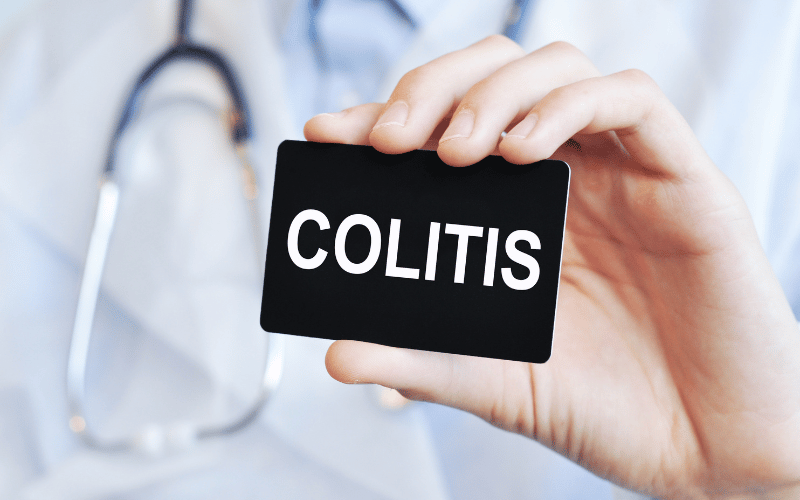 Decoding Collagenous Colitis