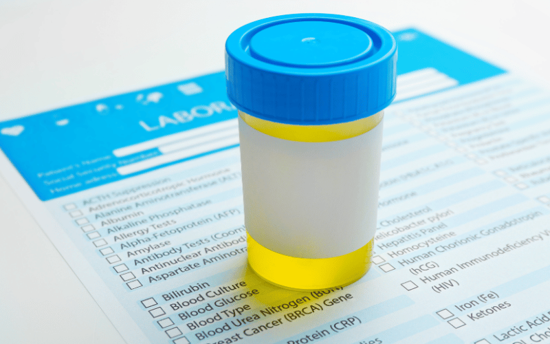 Decreased Urine Output