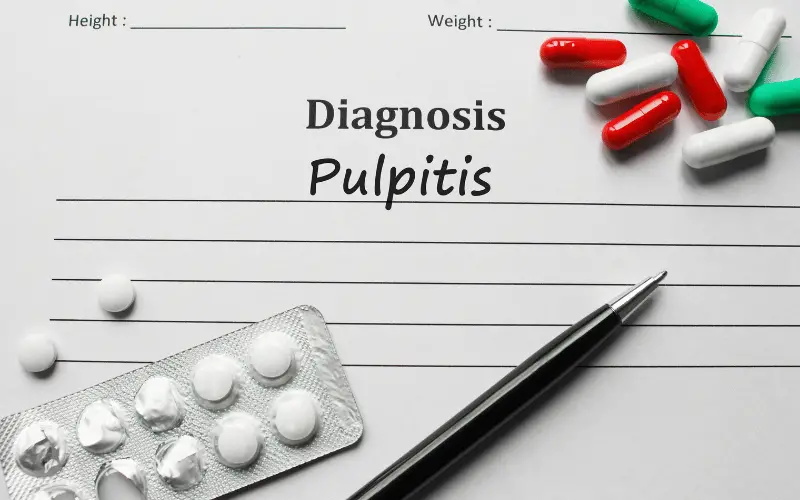 Delving into the World of Pulpitis