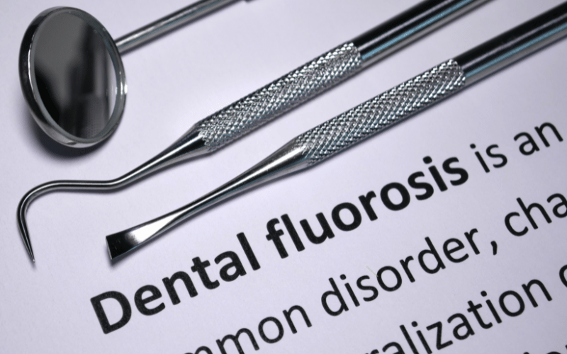 Dental Fluorosis Decoded Unveiling 10 Crucial Facts