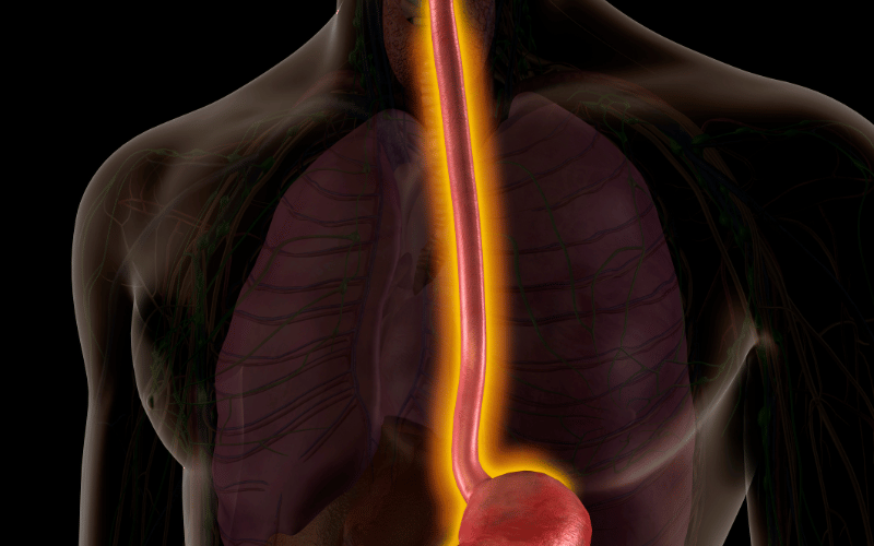 Esophageal Issues