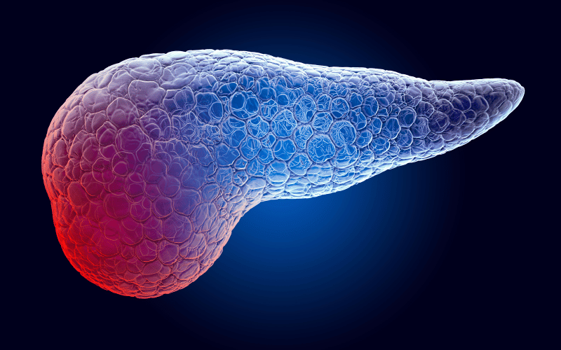 Exocrine Pancreatic Insufficiency (EPI)