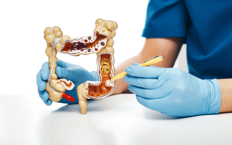 Frequently Asked Questions Illuminating the Shadows of Proctalgia Fugax