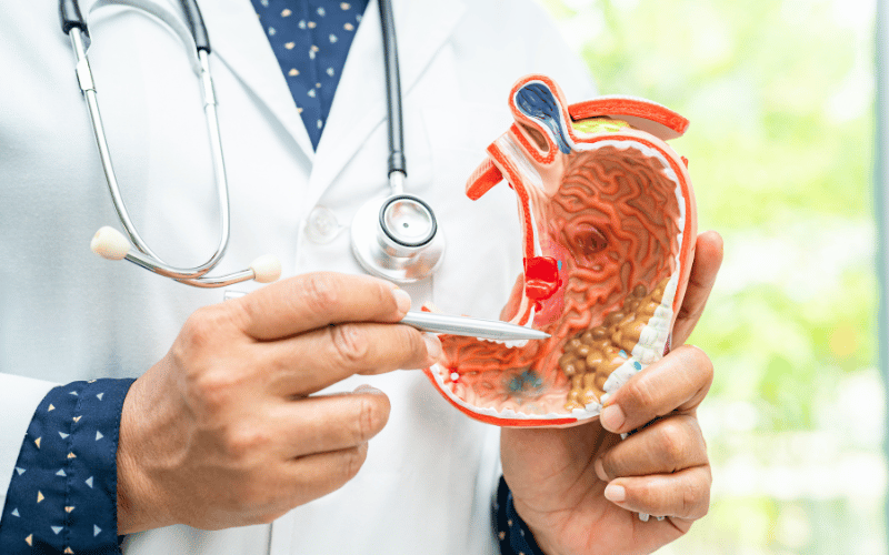 Frequently Asked Questions about Bile Duct Stones