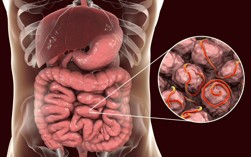 Gastrointestinal Infections