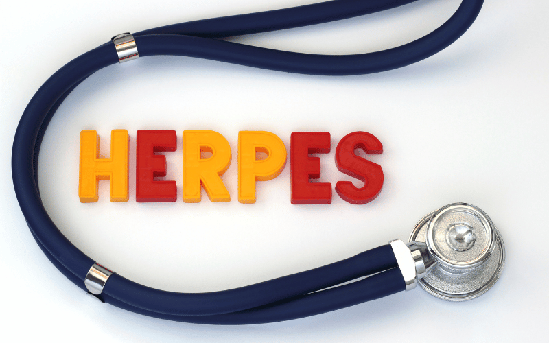 Genital Herpes Doesn’t Directly Impact Lifespan