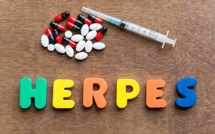 10 Critical Insights On The Prognosis Of Genital Herpes All You Need