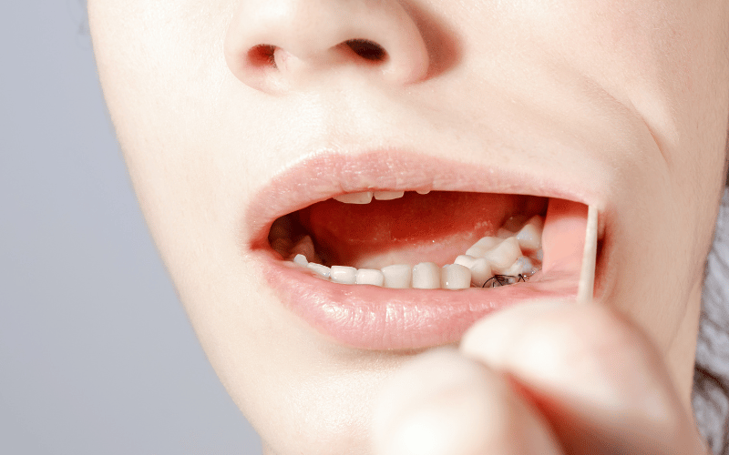 Gum Recession – A Sneaky Culprit