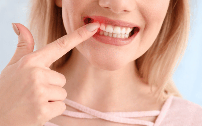 Gum Swelling and Inflammation A Red Flag for DI