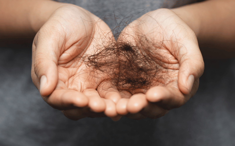 Hair Loss