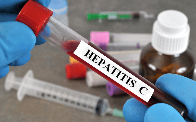 Hepatitis C's Stealth Mode