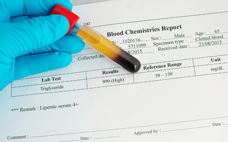 High Triglyceride Levels – A Lesser-Known Culprit