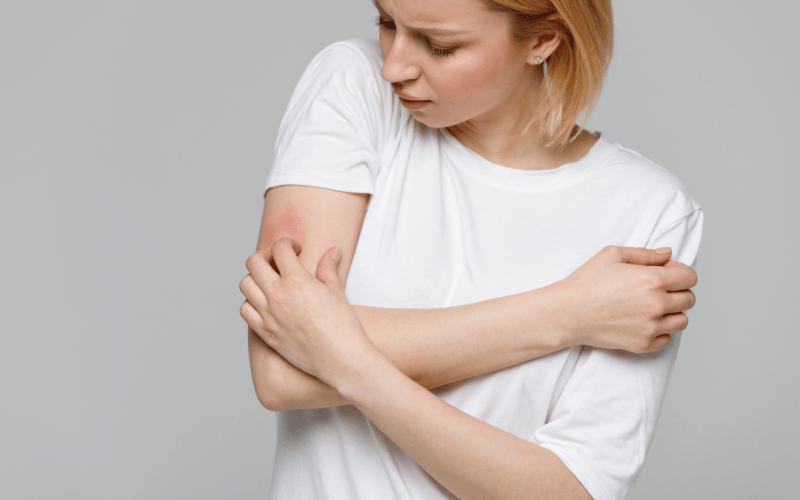 Itchy Skin An Overlooked Symptom