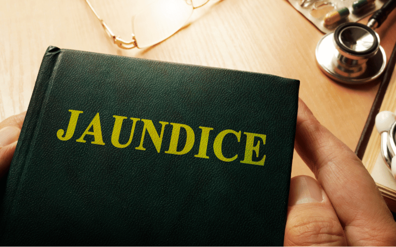 Jaundice