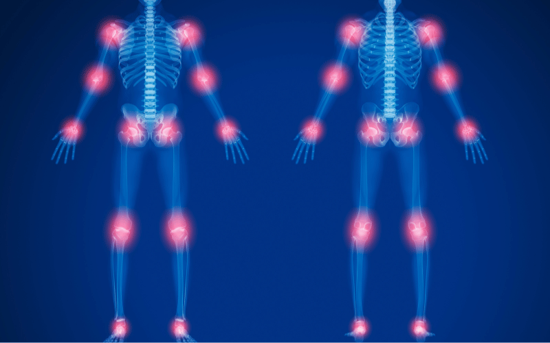 Joint Pain - Not Just a Sign of Aging