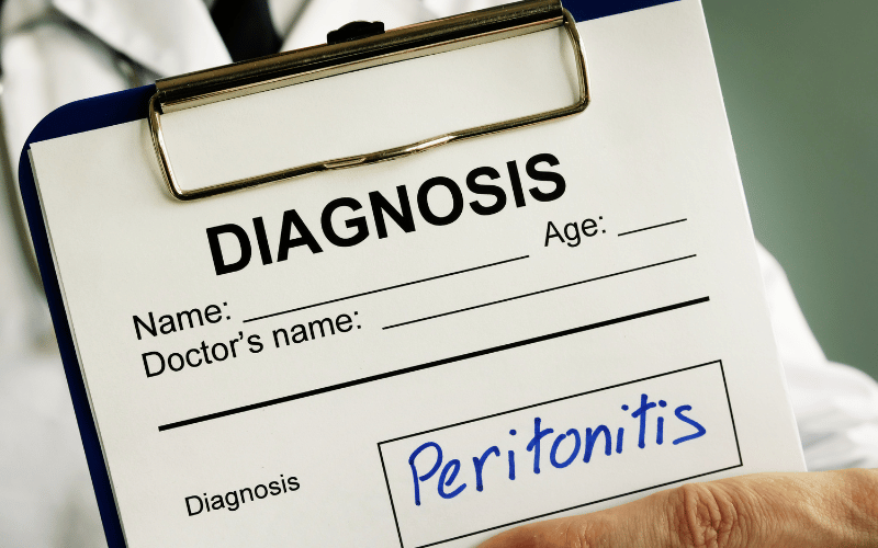 Navigating the Complex Terrain of Peritonitis Symptoms