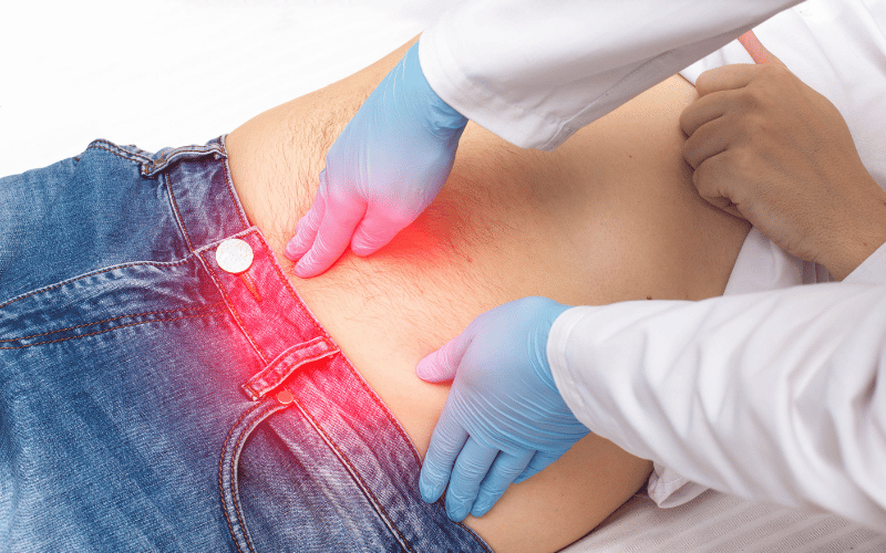 Navigating the Complex World of Richter’s Hernia Symptoms, Diagnosis, and Treatment