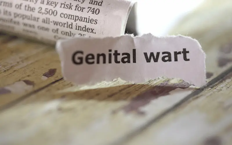 Navigating the Maze of Genital Wart Facts and Dispelling Myths