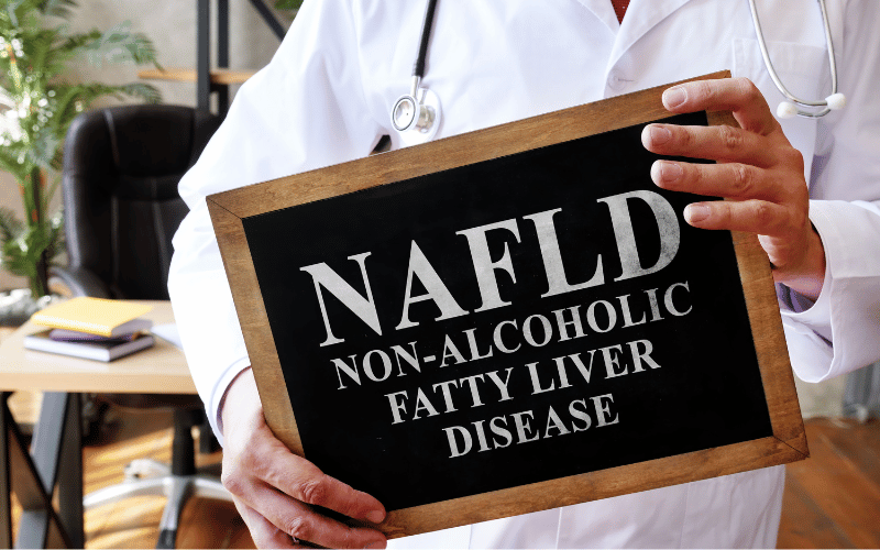 Navigating the Symptoms Top 10 Indicators of Non-Alcoholic Fatty Liver Disease (NAFLD)