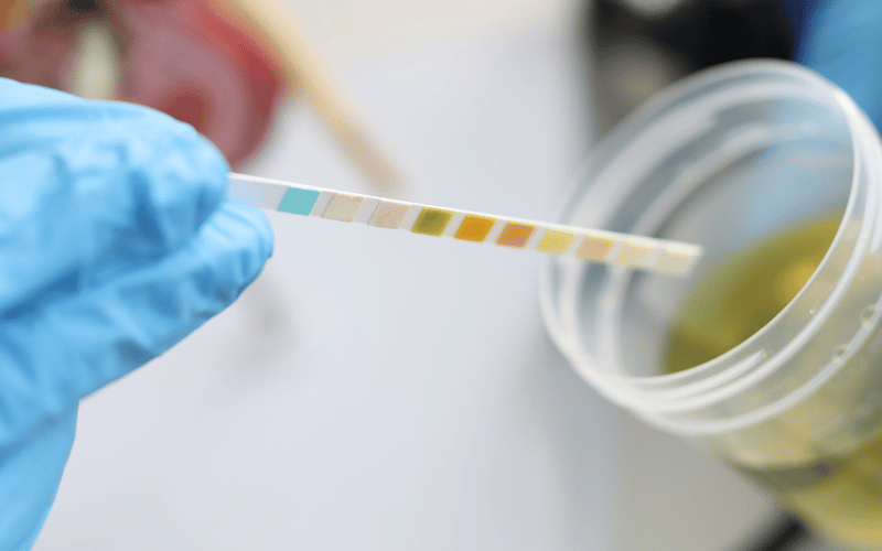 Protein in the Urine A Hidden Indicator