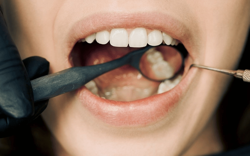 Pus Between Gums and Teeth – An Unsettling Sign