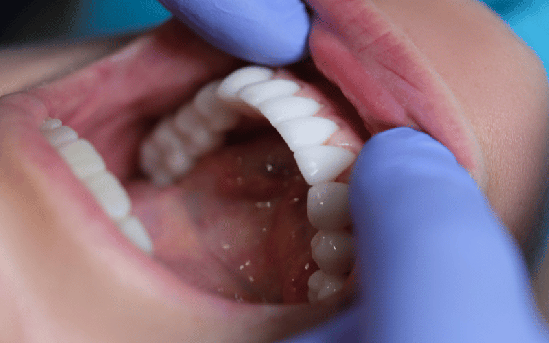 Relationship with Oral Health Does It Affect Gums and Teeth