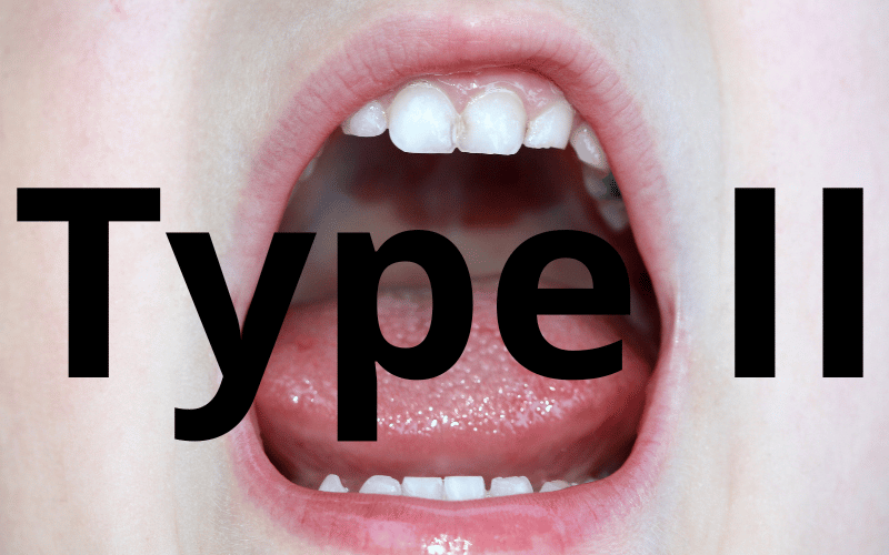 Submucosal Tongue Tie