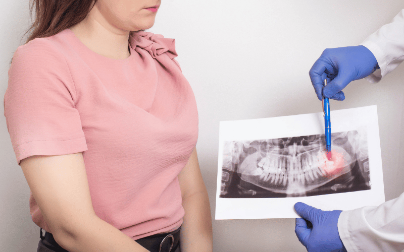 Swollen Gum Near a Tooth