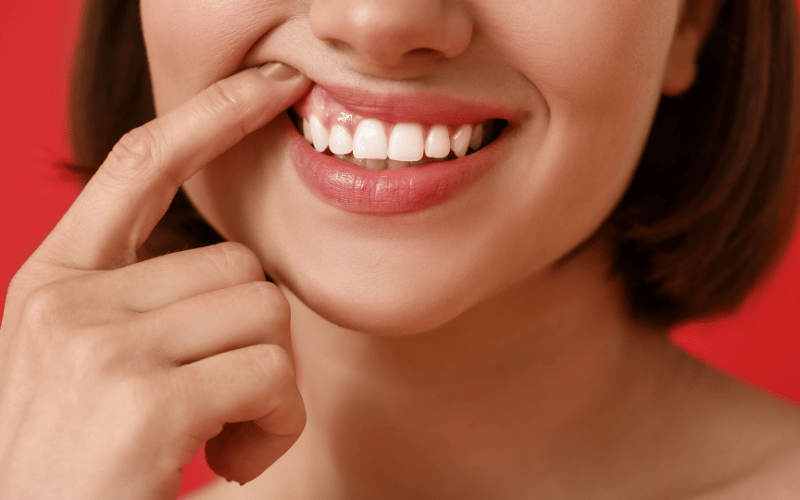 Tender Gums – A Painful Plight