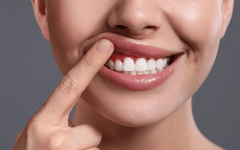 The Connection with Gum Disease