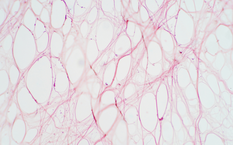 The Core of EDS - Connective Tissues