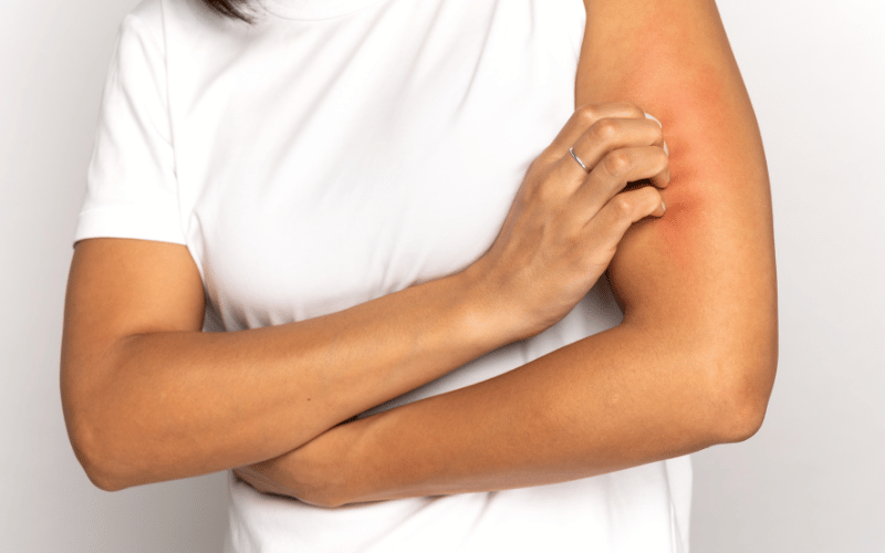 The Top 10 Symptoms of Pruritus Ani and Their Implications