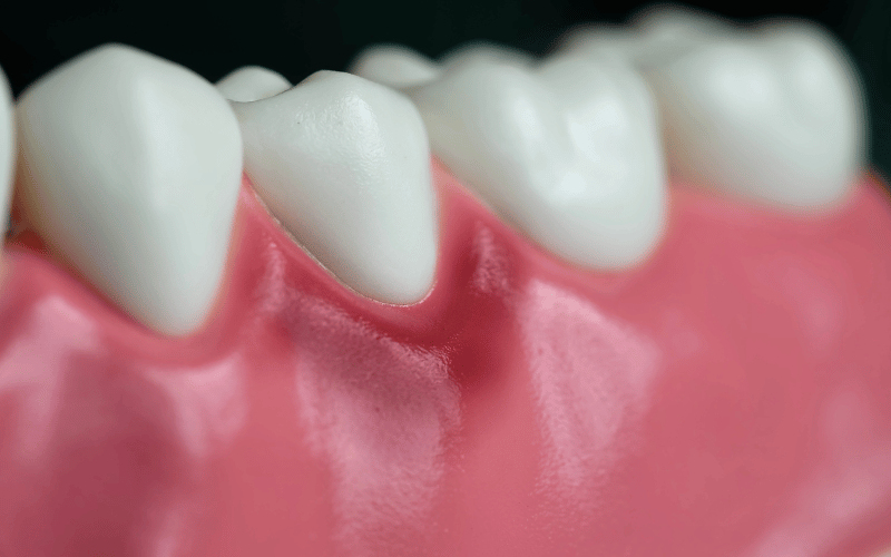 Understanding the Top 10 Causes of Gingivitis Unlocking the Mysteries