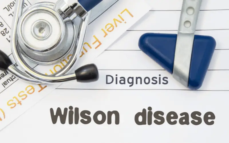 Unlocking the Mysteries of Wilson's Disease Causes and Insights