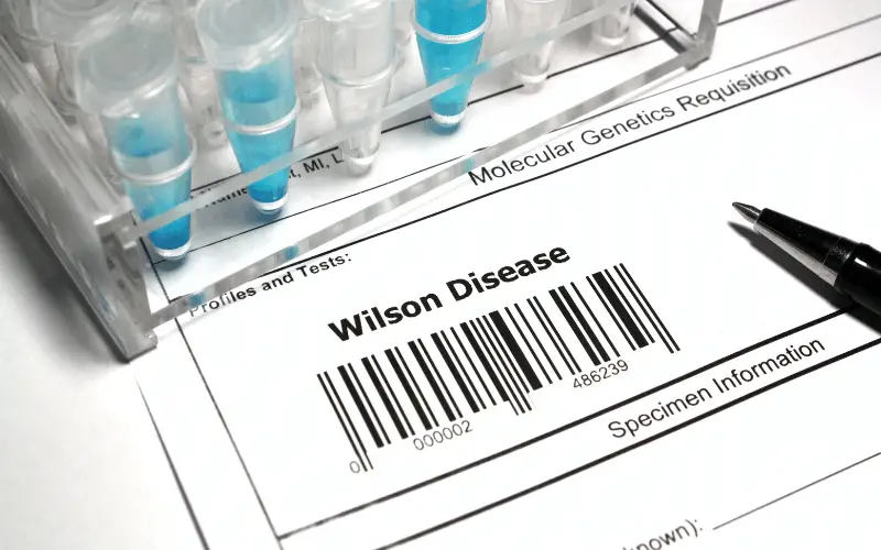 Unlocking the Mysteries of Wilson’s Disease Insights and Essential Facts