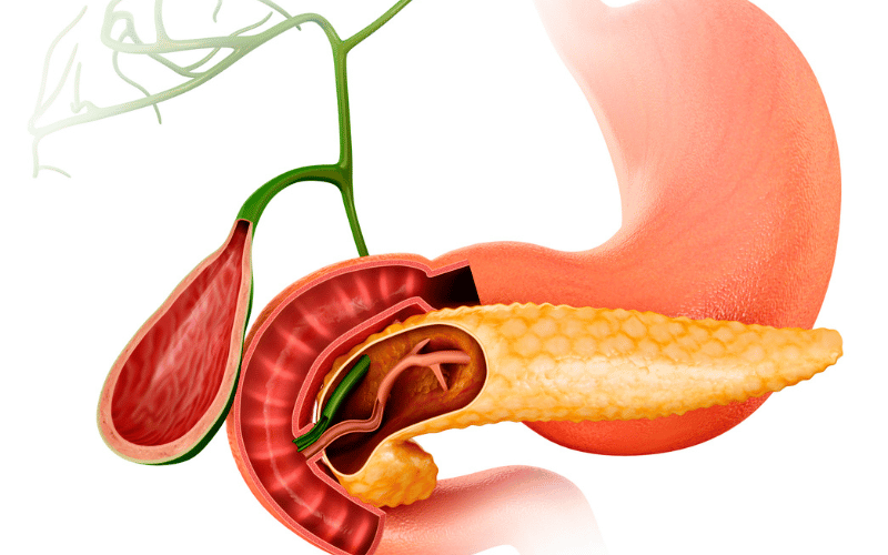 Unraveling the Mysteries 10 Symptoms of Exocrine Pancreatic Insufficiency (EPI)