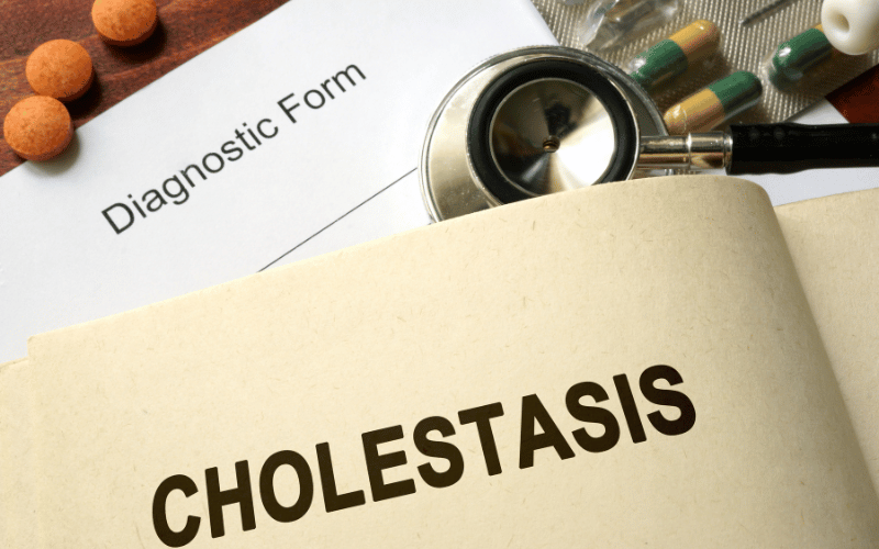 Unraveling the Mysteries 15 Vital Facts About Cholestasis